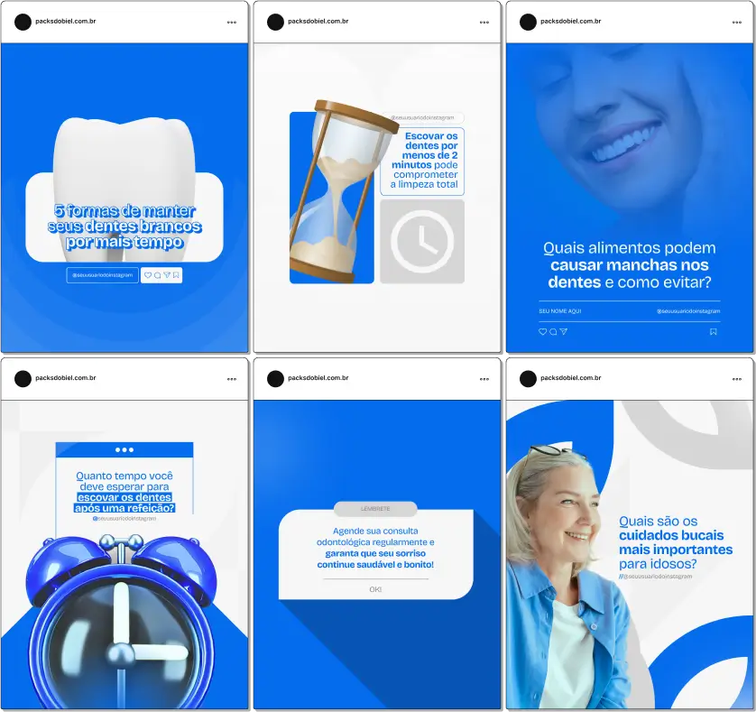 Perfil do Instagram com Artes e Posts Editáveis para Dentistas – Com este kit de posts e artes editáveis no Canva, dentistas e profissionais da odontologia podem criar conteúdos prontos para postar em perfis do Instagram e redes sociais. Inclui materiais sobre cuidados bucais, dicas de higiene, prevenção de cáries, tratamentos odontológicos, ortodontia, estética dental e muito mais. Ideal para fortalecer a presença digital, educar pacientes e atrair novos clientes para o consultório.