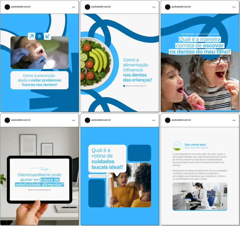 Conteúdos profissionais e visuais prontos para quem trabalha com Odontopediatria! Este Pack Canva traz artes editáveis e textos que abordam cuidados com os dentes das crianças, primeiras consultas, dentição de leite, selantes e educação bucal lúdica. Ideal para redes sociais de dentistas pediátricos que desejam atrair, educar e fidelizar pais e responsáveis.