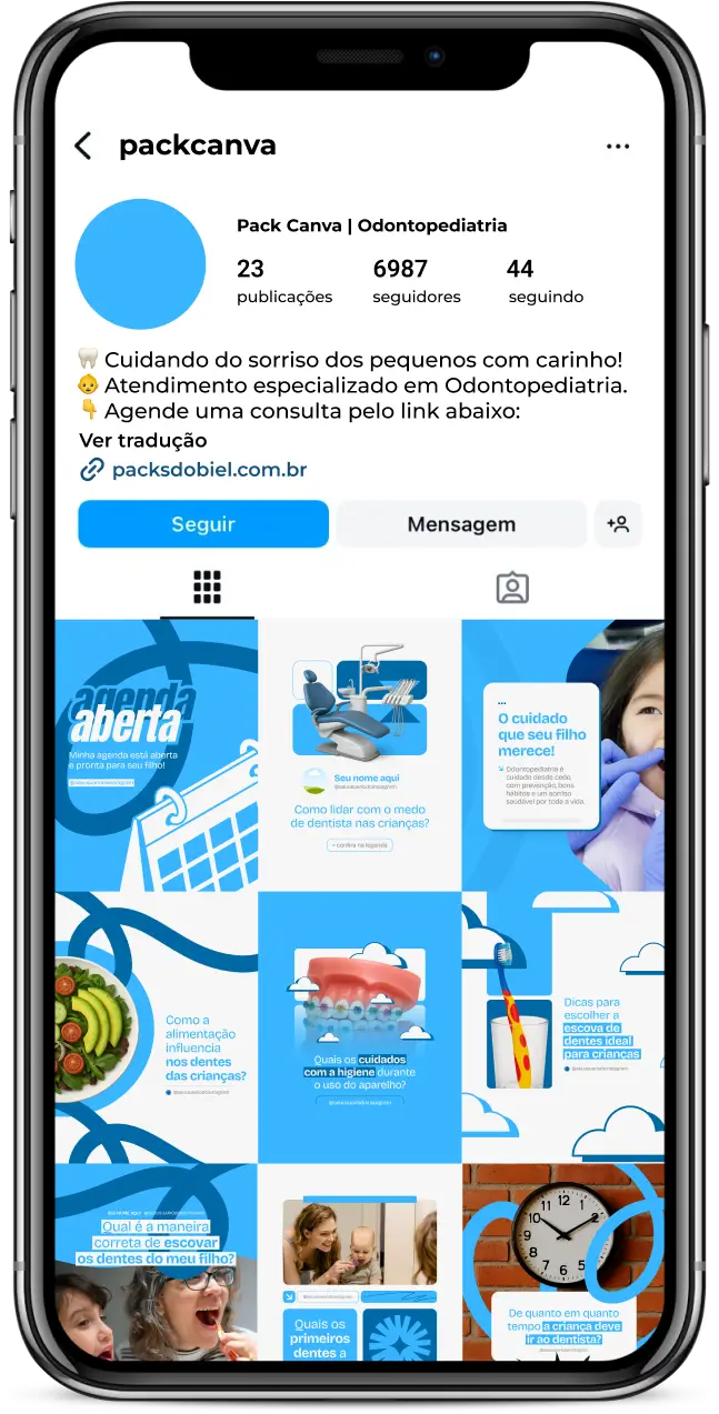 Transforme sua comunicação nas redes sociais com o Pack Canva para Odontopediatria. São posts visuais e educativos para Instagram, criados especialmente para profissionais que atuam com saúde bucal infantil. Aborda temas como prevenção odontológica, medo do dentista, dicas para os pais e rotina de cuidados desde os primeiros anos de vida.