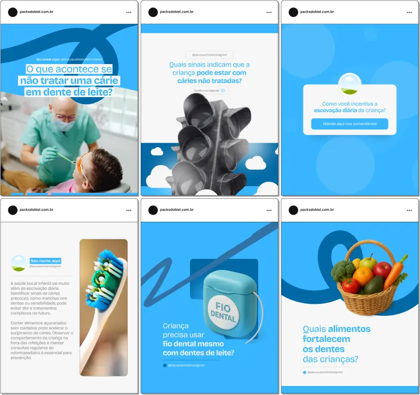Pack Canva Odontopediatria – Kit com posts e artes editáveis para dentistas pediátricos, clínicas odontológicas infantis e profissionais da saúde bucal. Conteúdos prontos para Instagram e redes sociais sobre prevenção de cáries, cuidados com dentes de crianças, higiene bucal, tratamentos odontológicos infantis, orientação para pais e dicas de saúde dental.