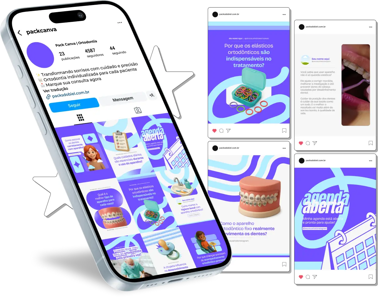 Kit de posts editáveis no Canva para ortodontistas e dentistas especializados. Inclui artes sobre alinhadores invisíveis, aparelhos fixos e móveis, cuidados pós-tratamento, dicas de higiene oral, prevenção de cáries e curiosidades odontológicas. Ideal para aumentar o engajamento, educar pacientes e conquistar novos clientes de forma estratégica.