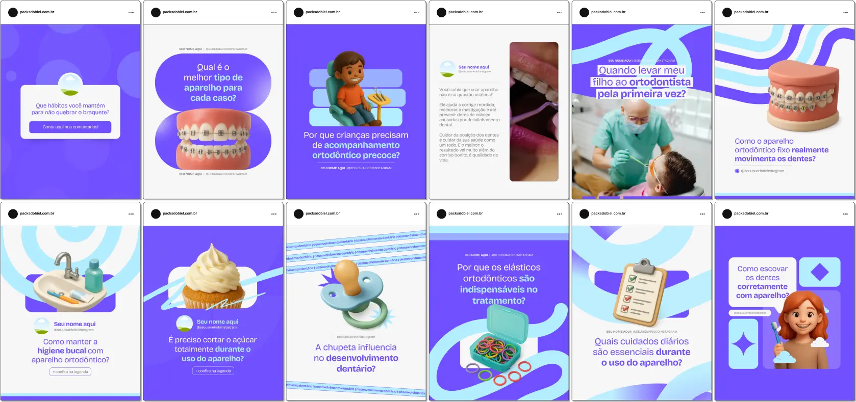 Com o Pack Canva Ortodontia, você terá posts prontos para compartilhar informações educativas sobre correção dentária, manutenção de aparelhos, resultados de tratamentos e orientações de saúde bucal. O kit é totalmente personalizável no Canva, permitindo criar um perfil profissional, engajador e visualmente atraente no Instagram e outras redes sociais.