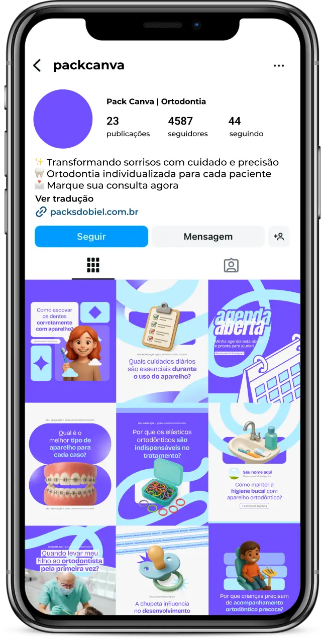 Kit de posts editáveis no Canva para ortodontistas e dentistas especializados. Inclui artes sobre alinhadores invisíveis, aparelhos fixos e móveis, cuidados pós-tratamento, dicas de higiene oral, prevenção de cáries e curiosidades odontológicas. Ideal para aumentar o engajamento, educar pacientes e conquistar novos clientes de forma estratégica.
