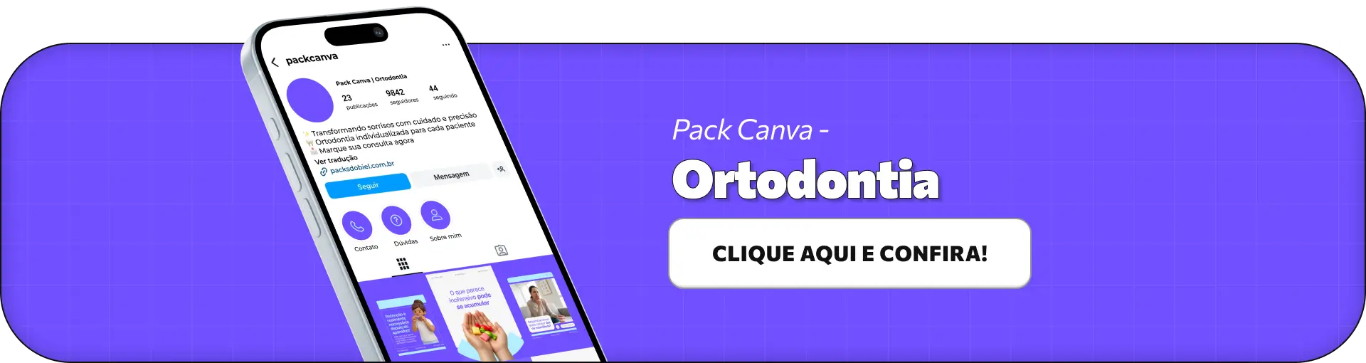 Pack de posts editáveis no Canva para ortodontistas que produzem conteúdos sobre aparelhos dentários, alinhamento dental, mordida, correções ortodônticas e manutenção do sorriso, ideal para manter um feed organizado, profissional e informativo no Instagram.