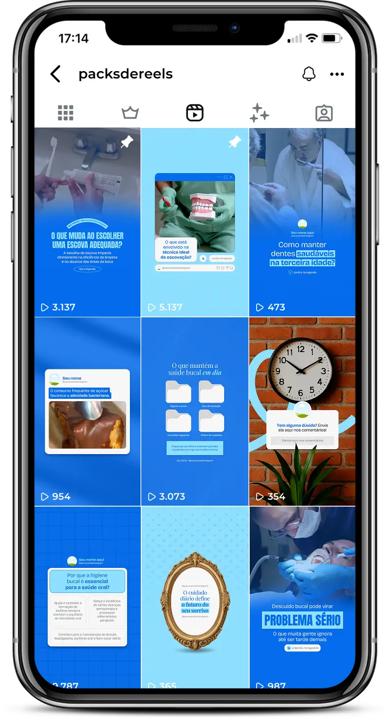 Reels para dentistas com vídeos editáveis para Instagram profissional