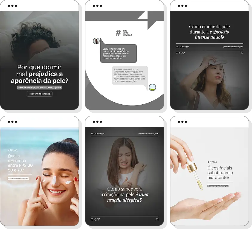 Pack de posts para dermatologista com templates no Canva para Instagram sobre pele, saúde e cuidados diários
