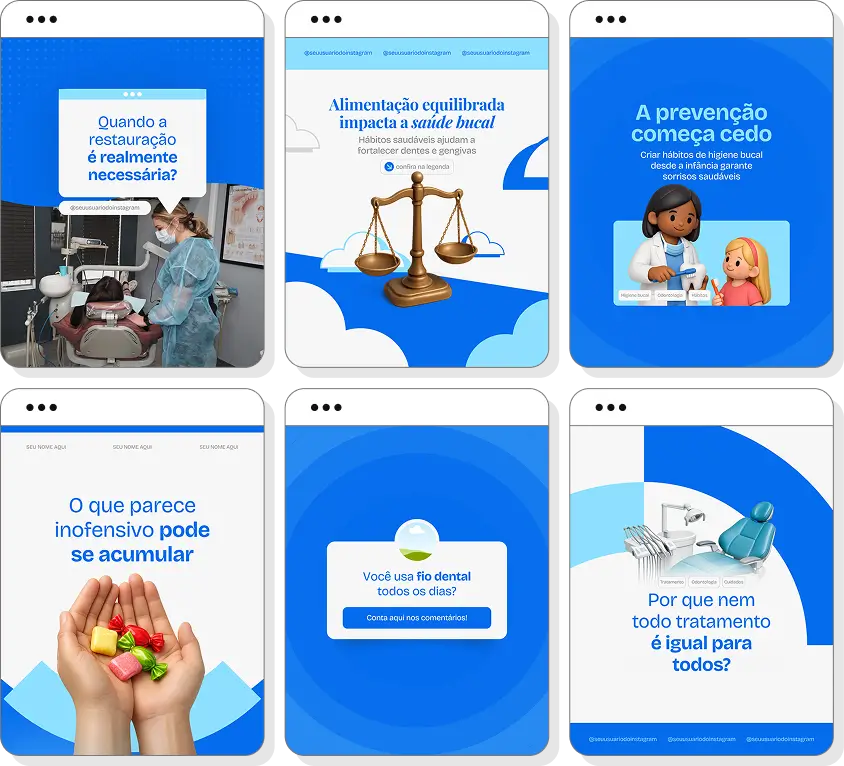 Posts para odontologia com pack de conteúdo editável no Canva para Instagram de saúde bucal