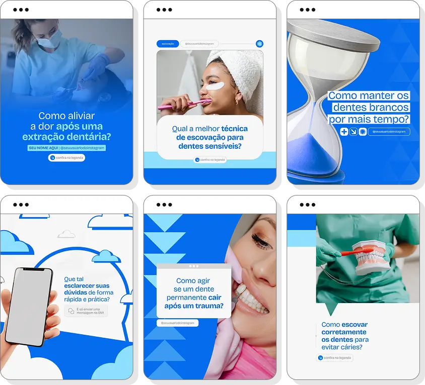 Pack de posts odontologia com conteúdo para Instagram de saúde bucal e tratamentos odontológicos