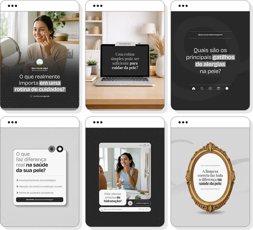 Social media para dermatologista com pack de posts editáveis no Canva para Instagram médico