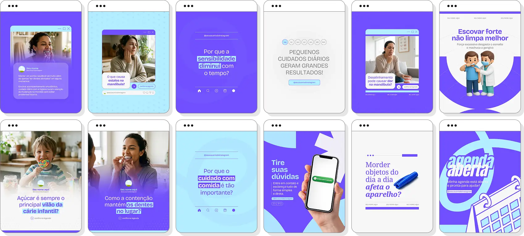 Pack Canva ortodontia com posts editáveis para Instagram de aparelhos ortodônticos e saúde bucal