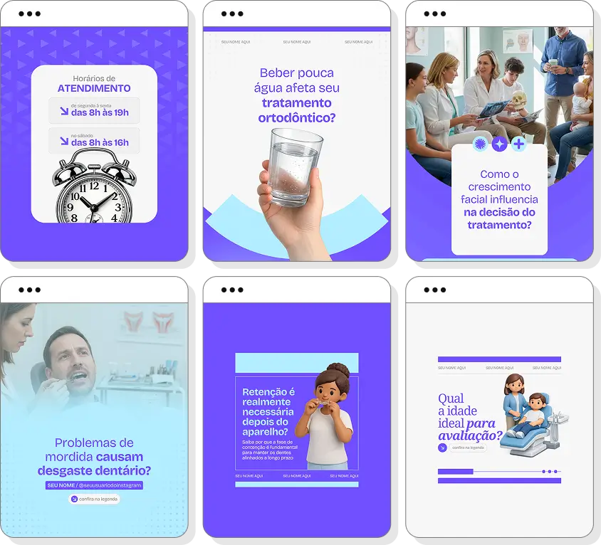 Pack de posts para ortodontia com templates no Canva para Instagram sobre alinhamento dental e sorriso