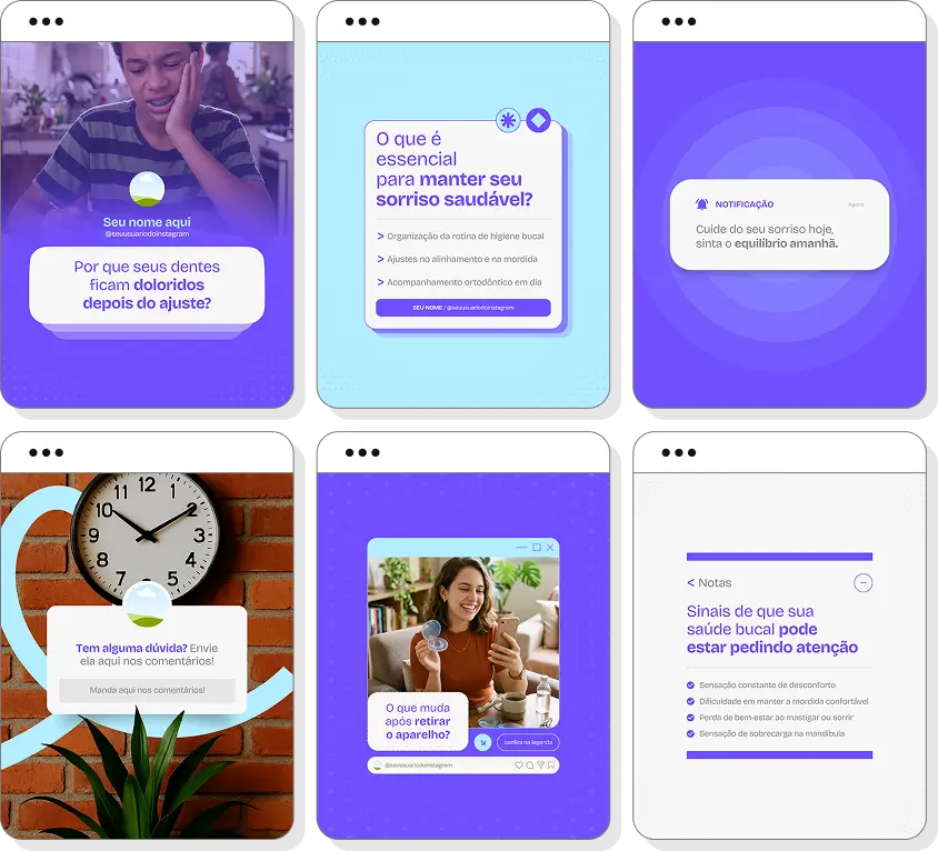 Pack Canva ortodontia com ideias de posts para perfil de Instagram sobre alinhamento dos dentes