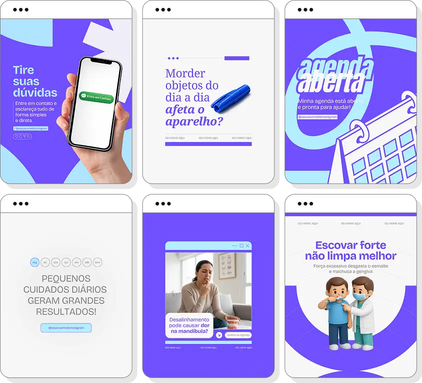 Pack de posts para Instagram ortodontia com artes editáveis sobre aparelhos ortodônticos