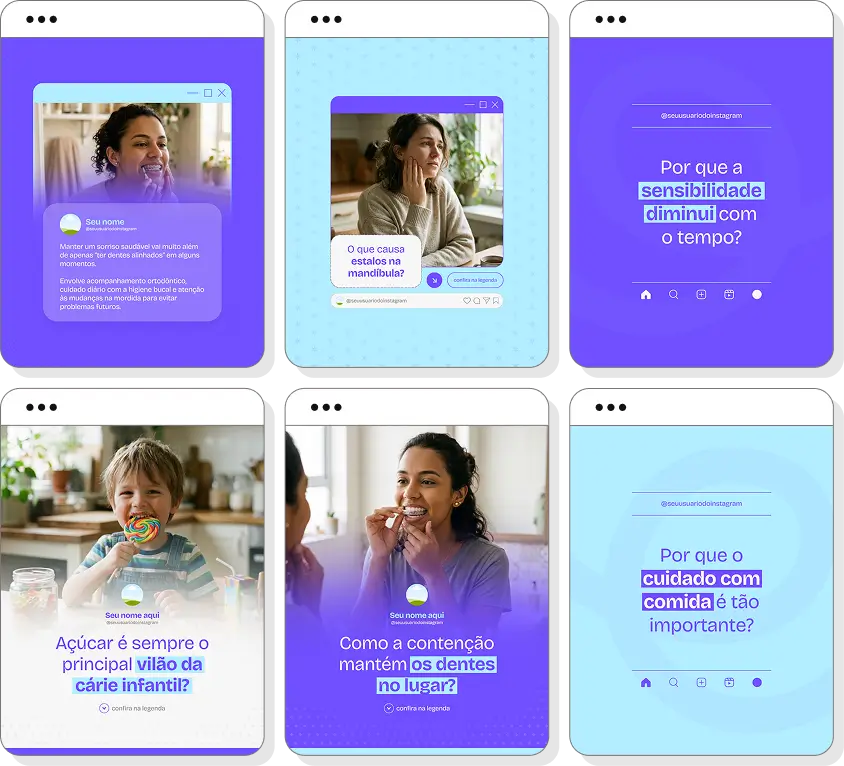 Ideias de post para ortodontia com pack de conteúdo para Instagram sobre correção dental