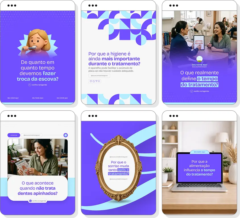 Pack Canva ortodontia com posts para Instagram de sorriso alinhado e aparelhos dentários
