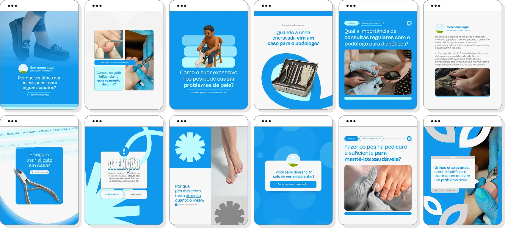 Social media para podologia com pack de posts editáveis no Canva para Instagram profissional