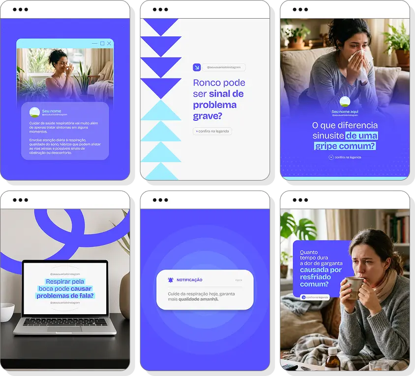 Posts para perfil de otorrinolaringologia no Instagram com templates Canva sobre saúde auditiva