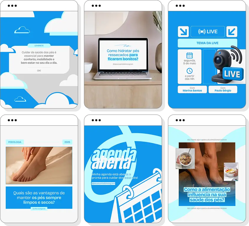 Pack Canva podologia com ideias de posts para perfil de Instagram sobre podólogo e cuidados com os pés