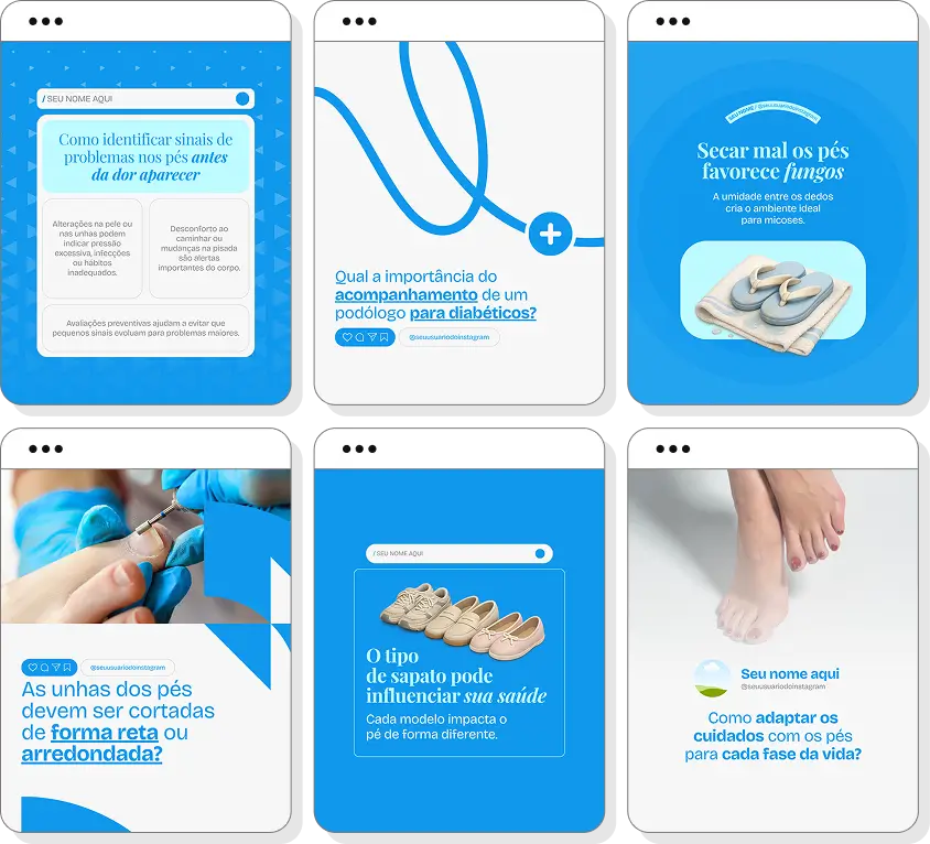Pack de posts editáveis podologia com foco em saúde dos pés e prevenção de problemas podológicos