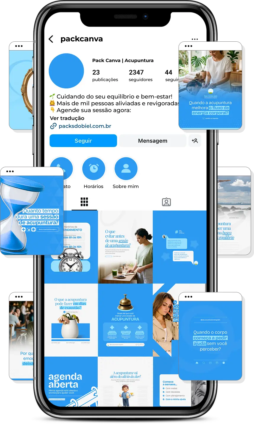 Pack Canva Acupuntura com posts editáveis para Instagram sobre acupuntura, bem-estar, terapias integrativas e saúde
